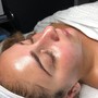 LED Light Therapy Facial