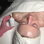 Dermaplane Facial