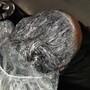 Scalp Treatment