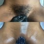 Hot Oil Treatment