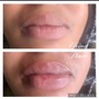 Lip Lightening