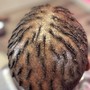 Scalp Treatment