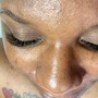 Facial