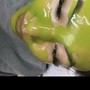 Radio Frequency Facial