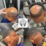 Patch Work ( Bald Spot Restoration) /Haircut