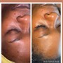 Dermaplaning (NO FACIAL) Can ADD ON to Facial