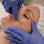 Microdermabrasion with LED therapy