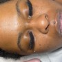 Oxygen Facial