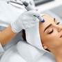 Microdermabrasion Facial