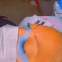 Eyelash Extension Removal