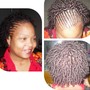 Scalp Treatment