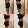 Non surgical Brazilian butt lift