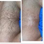 VAJACIAL + Brazilian Wax (Must Be 18+)