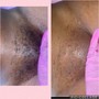 VAJACIAL + Brazilian Wax (Must Be 18+)