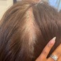 Scalp Treatment