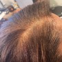 Scalp Treatment