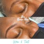 Acne Facial