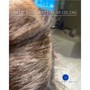 Medical Hair Restoration needling