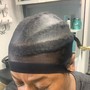 Scalp Treatment