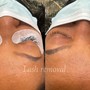 Eyelash Extension Removal