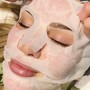 Microdermabrasion facial