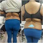 Body Contouring Single Session