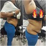 Body Contouring Single Session