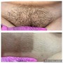 Brazilian Wax ONLY (Must Be 18+)