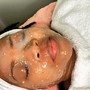 Teen Facial