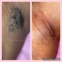 Underarm Wax