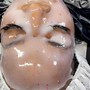 High Frequency Facial