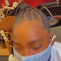 Scalp Treatment