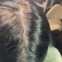 Scalp Micro Pigmentation(Front Edges)