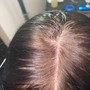 Scalp Micro Pigmentation(Front Edges)