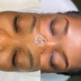 Facial