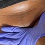 Brazilian Sugaring, Underarm Sugaring