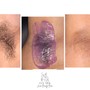 Women’s Brazilian Wax