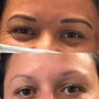 Eyebrow: Microblading