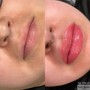 LIP THREADING