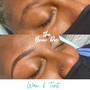 Acne Facial