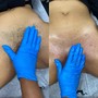 Bikini Wax