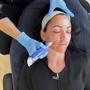 Scalp Treatment