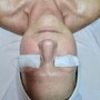 Back Facial