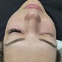 Back Facial