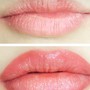 Lip Sugaring