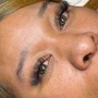 Eyelash Extension Removal