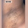 Underarm Wax