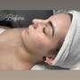 Microdermabrasion