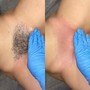 Brazilian Wax