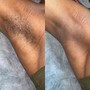 Brazilian Wax, Underarm Wax